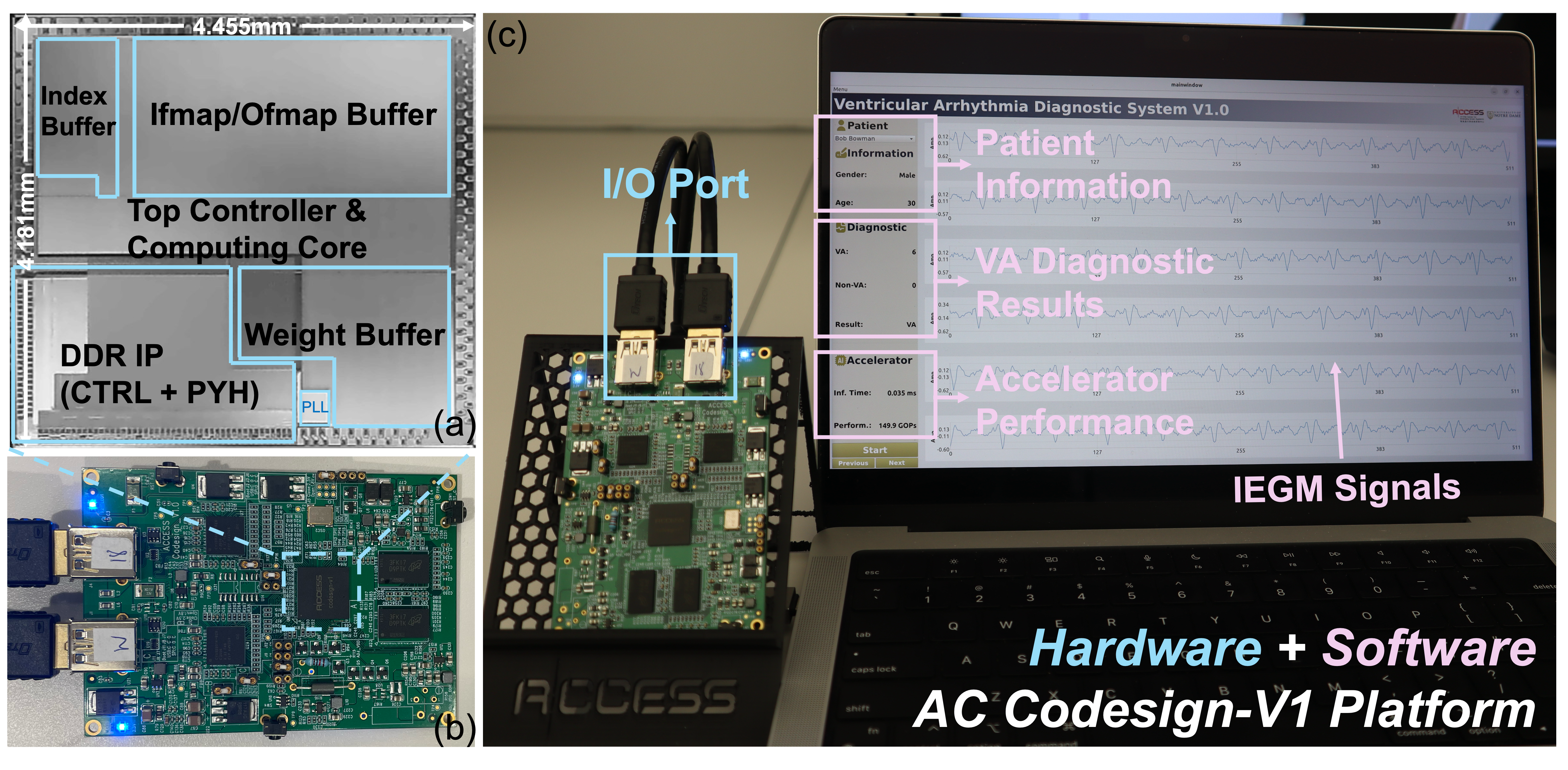 Real-time ventricular arrhythmia detection interface
