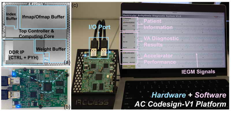 Real-time ventricular arrhythmia detection interface